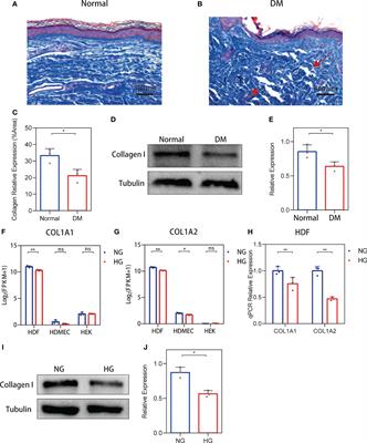 The Imbalance of MMP-2/TIMP-2 and MMP-9/TIMP-1 Contributes to Collagen Deposition Disorder in Diabetic Non-Injured Skin